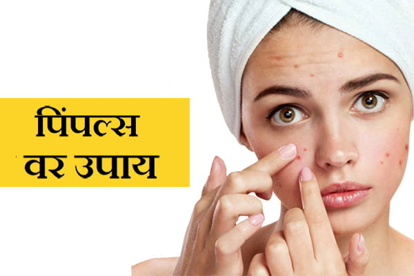 Pimples information in Marathi