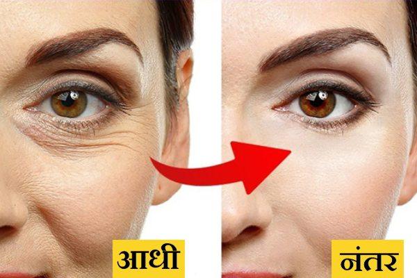 How To Get Rid Of Face Wrinkles Quickly