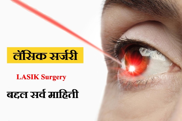 Lasik Surgery Information in Marathi