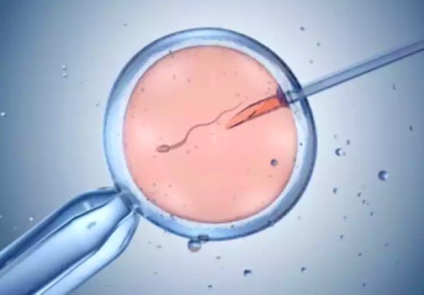 Retrieving the spermatozoa